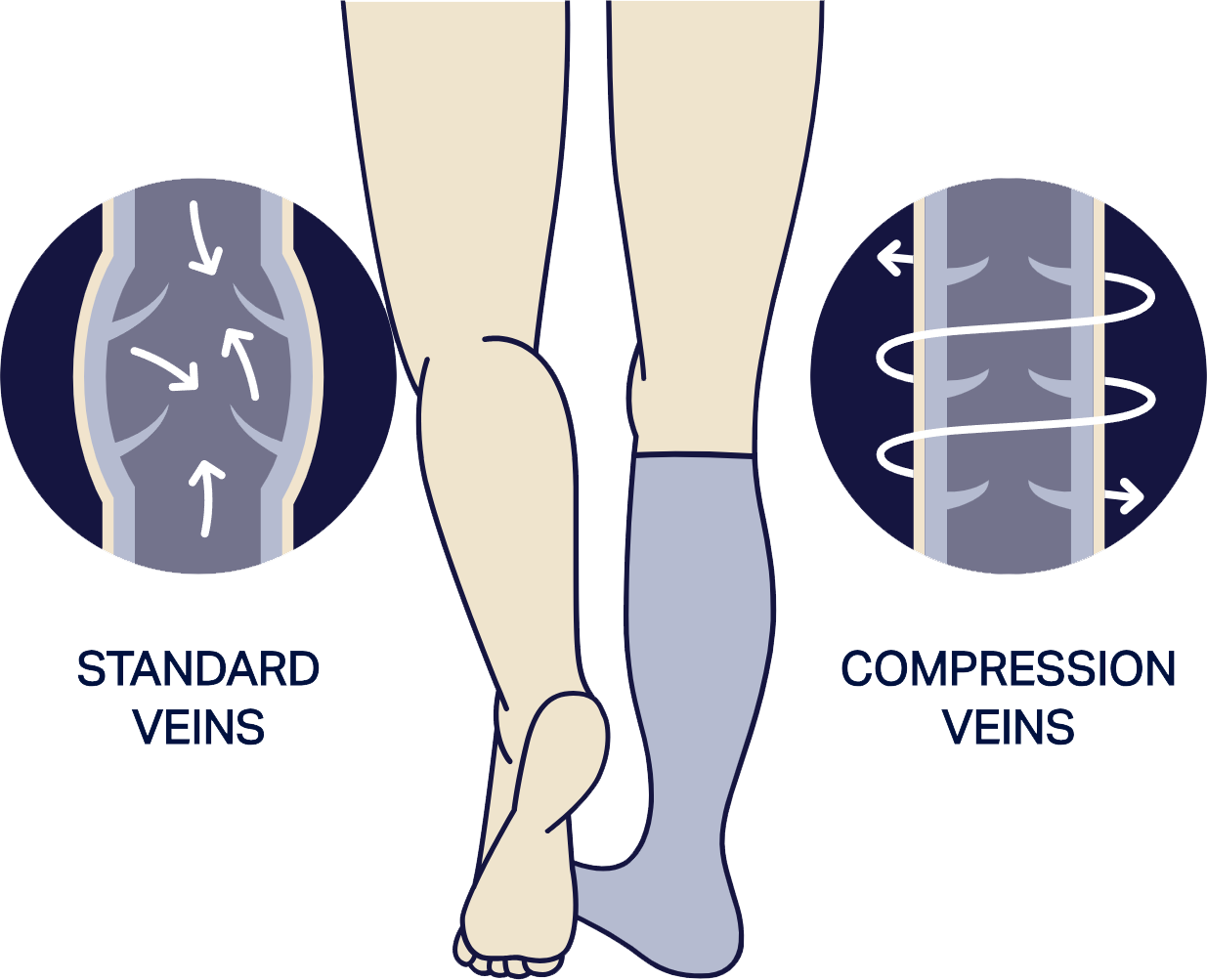 What Are Compression Socks & What Do They Do | Comrad Socks